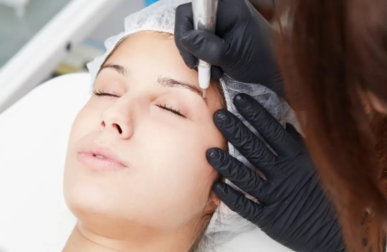 Things to Know About Laser Treatment